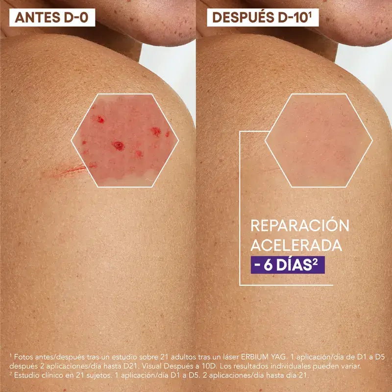 A-Derma Exomega Epithelial Ah Ultra-Repairing Anti-Scarring Cream 40 ml