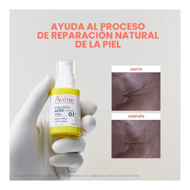 Avène Hyaluron Activ Procedure Lifting Serum 0.1% Retinal 30ml