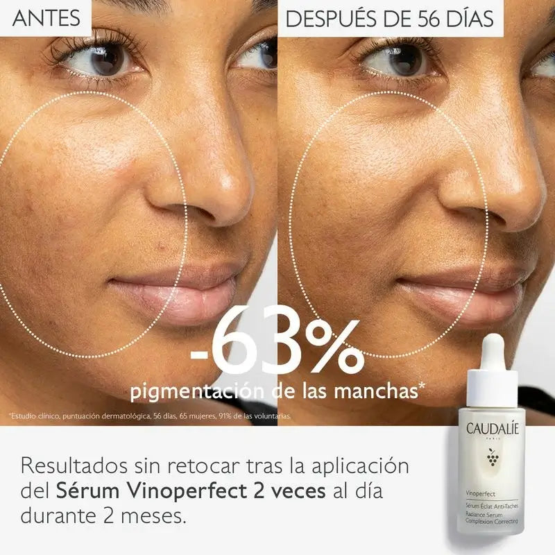 Caudalie Vinoperfect Anti-Blemish Radiance Serum 30 ml