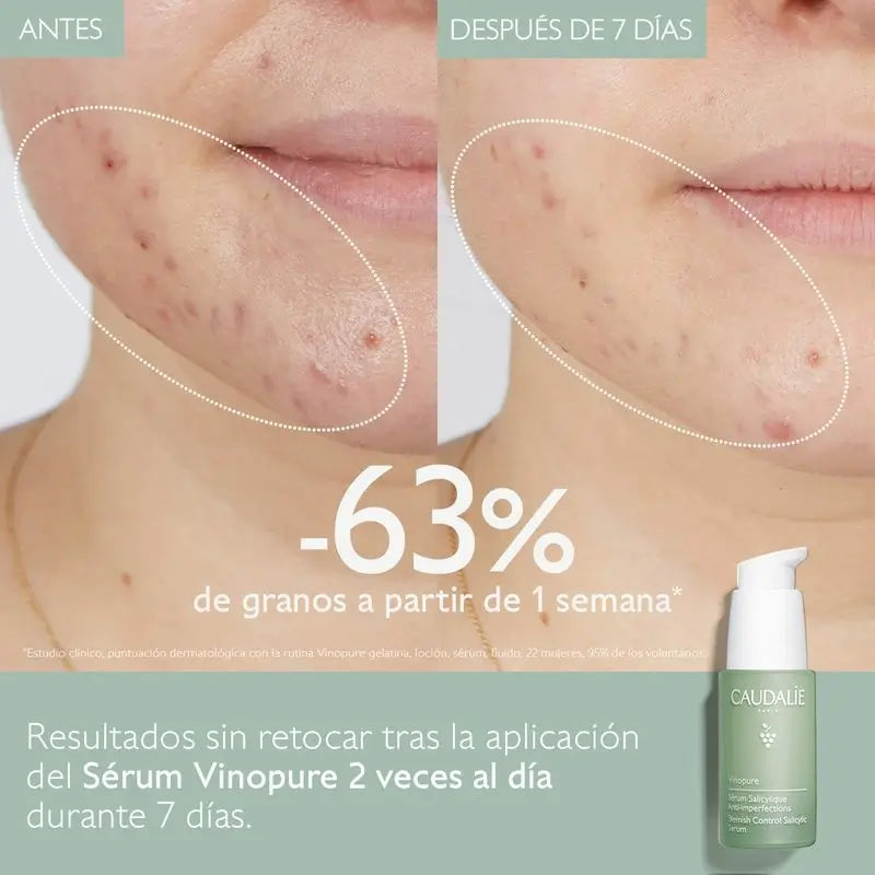 Caudalíe Vinopure Anti-Imperfections Salicylic Serum - 30 ml