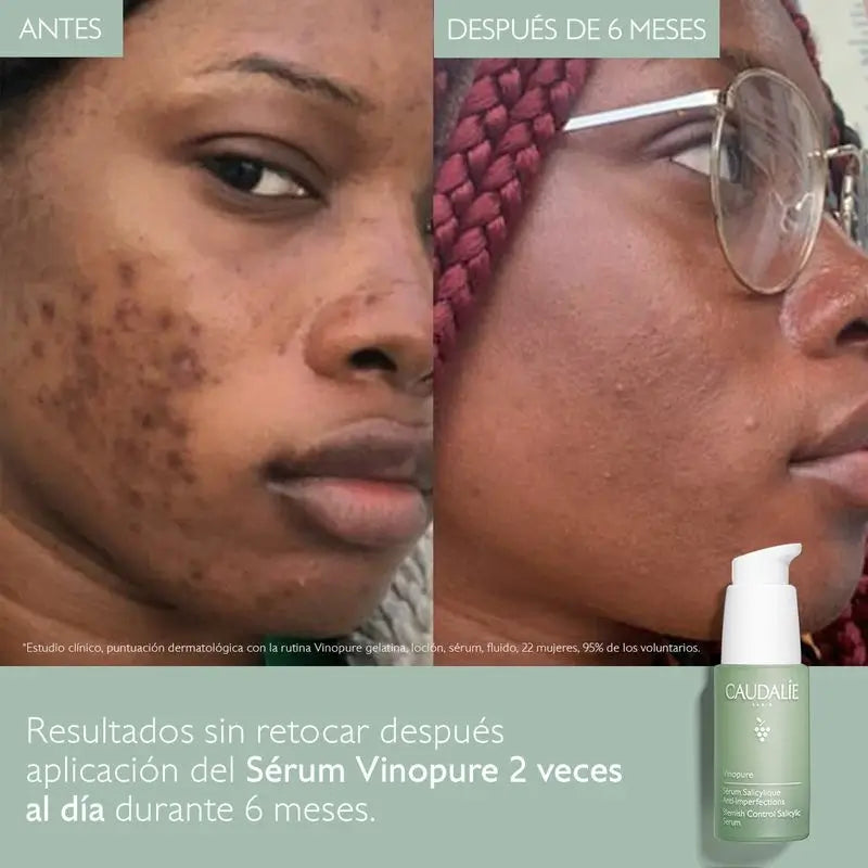 Caudalíe Vinopure Anti-Imperfections Salicylic Serum - 30 ml