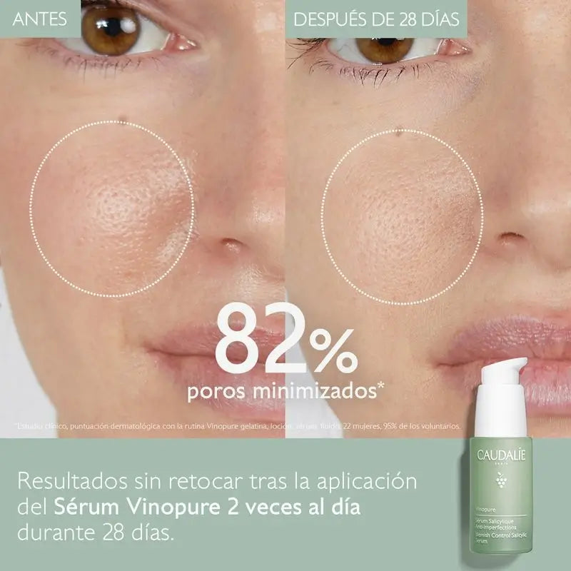 Caudalíe Vinopure Anti-Imperfections Salicylic Serum - 30 ml