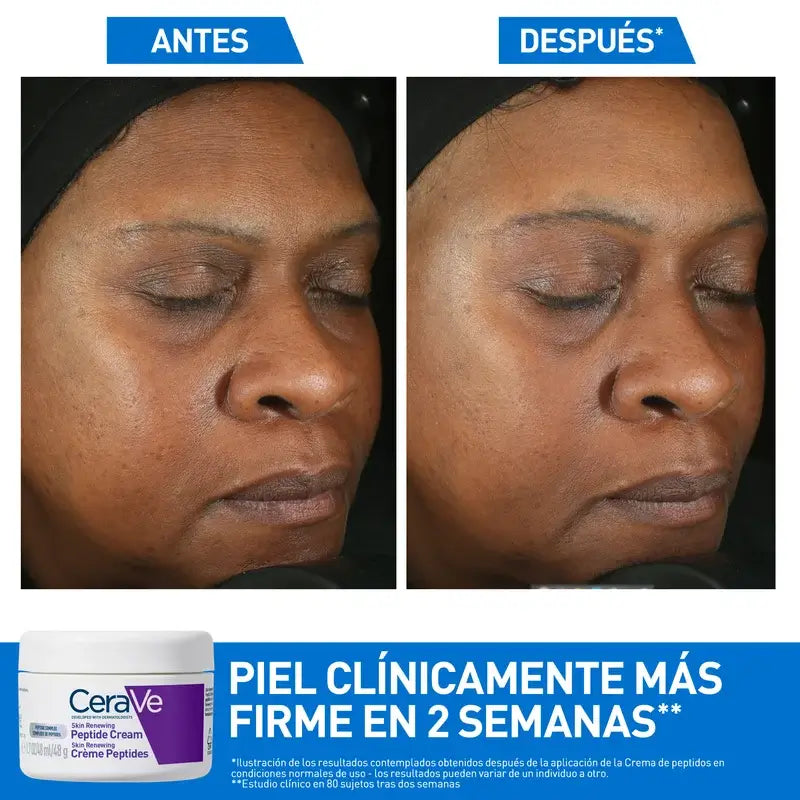 Cerave Skin Renewing Cream with Peptides , 48 ml