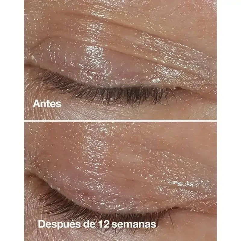 Clinique Smart Clinical Repair Anti-Wrinkle Correcting Eye Cream, 3x15 ml