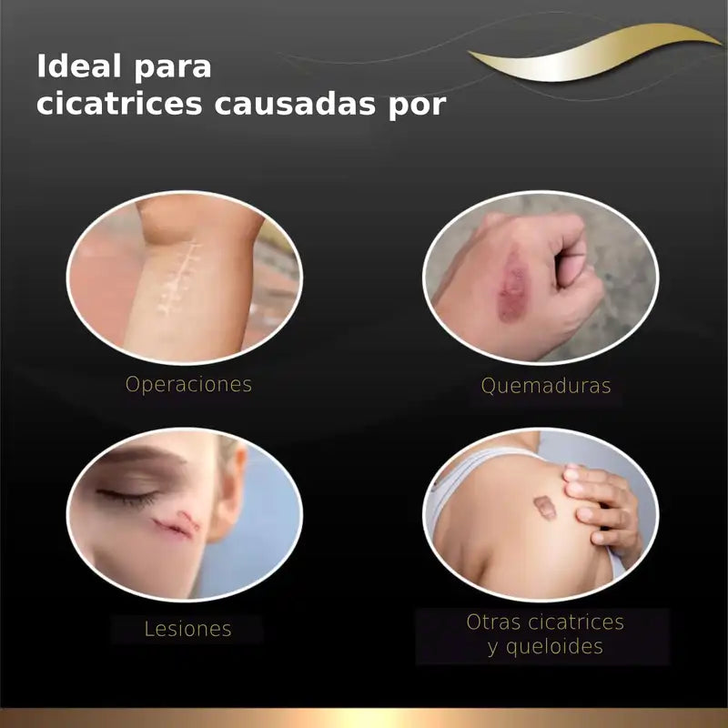 Dermatix Silicone Gel Scar Treatment, 15g