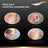 Dermatix Silicone Gel Scar Treatment, 15g