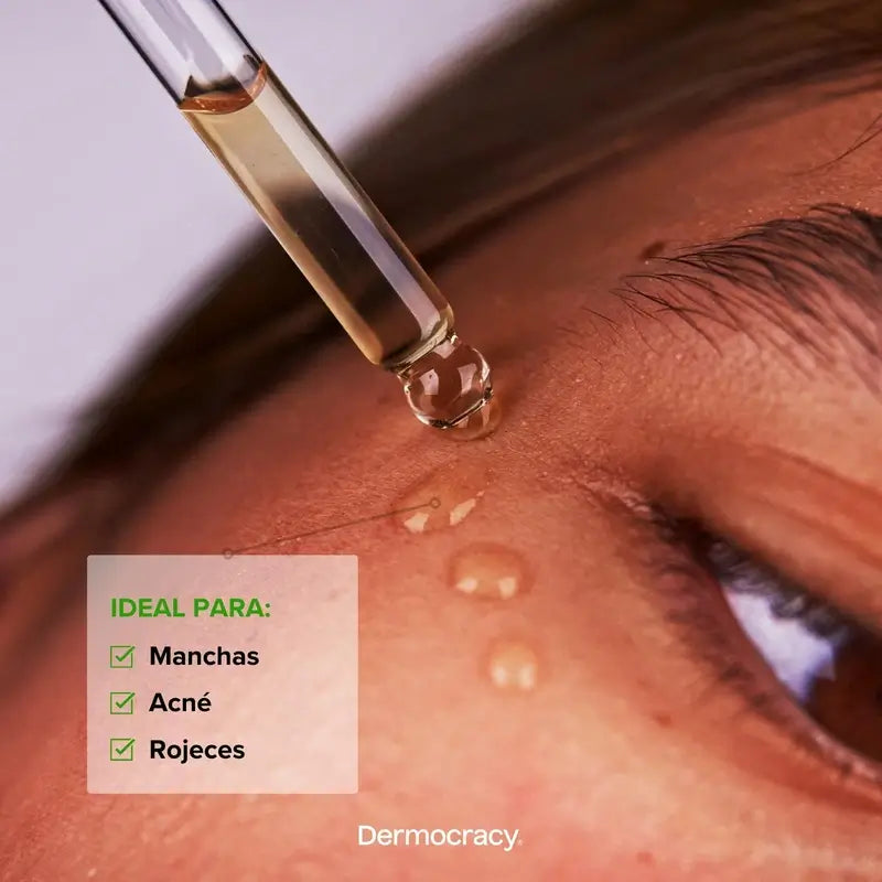 Dermocracy Soothing Azelaic Serum 10%.