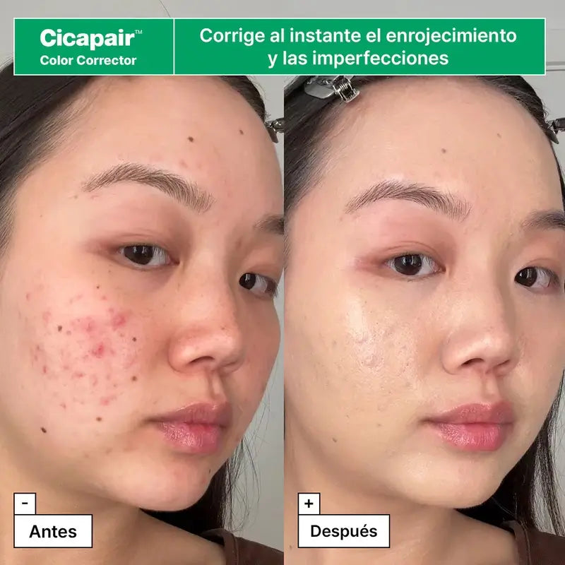 Dr.Jart+ Reddened Skin Rescue Kit with Centella asiatica