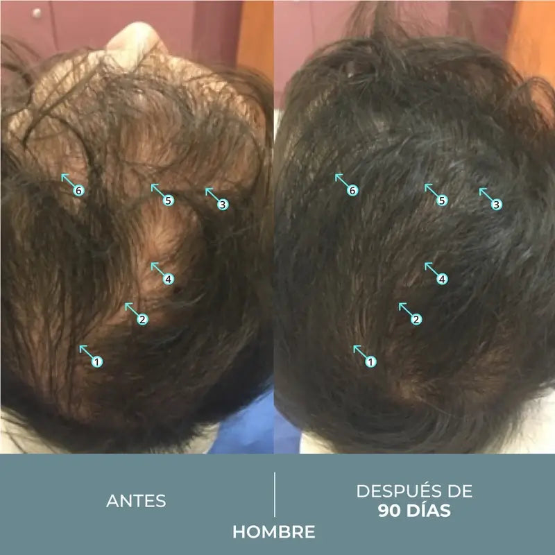 Ds Laboratories Revita Sod Anti-Hair Loss Tablets, 30 pcs