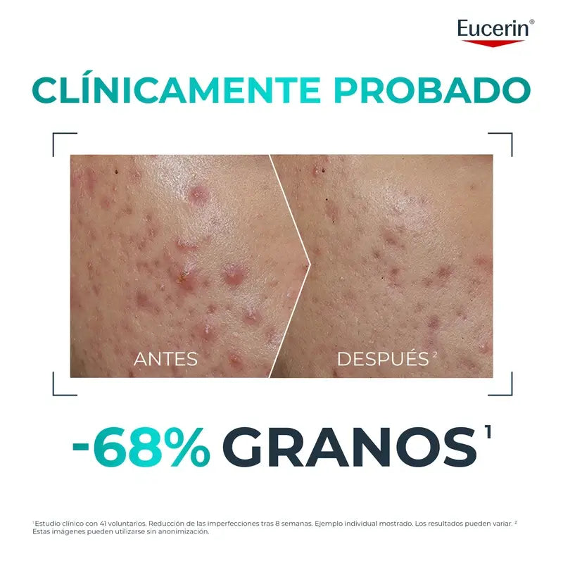 Eucerin Dermopure Clinical Probiom8 kit