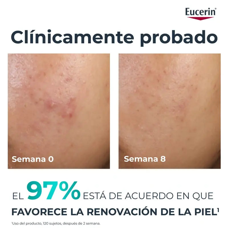 Eucerin Dermopure Peeling 10% Hydroxy Acids, 40 ml