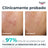 Eucerin Dermopure Peeling 10% Hydroxy Acids, 40 ml