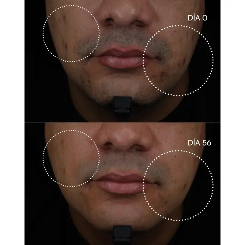 Gema Herrerías 10 Aha Chemical Peeling, 20 units