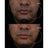 Gema Herrerías 10 Aha Chemical Peeling, 20 units