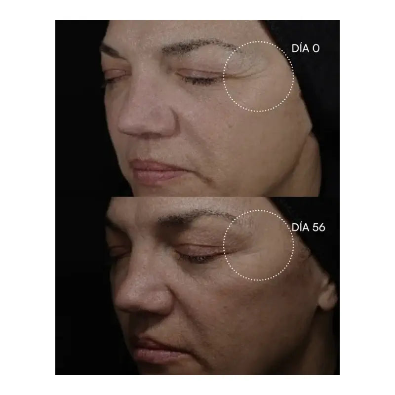 Gema Herrerías 20 Chemical Peeling 20 Discs 23 ml