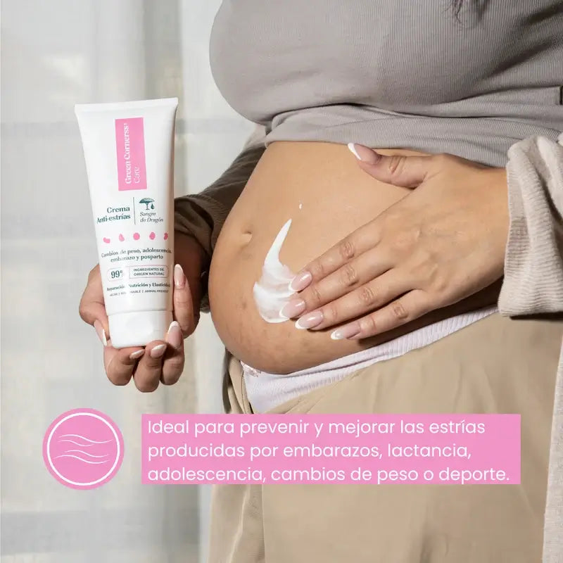 Green Cornerss Dragon's Blood Anti Stretch Mark Cream, 200 ml