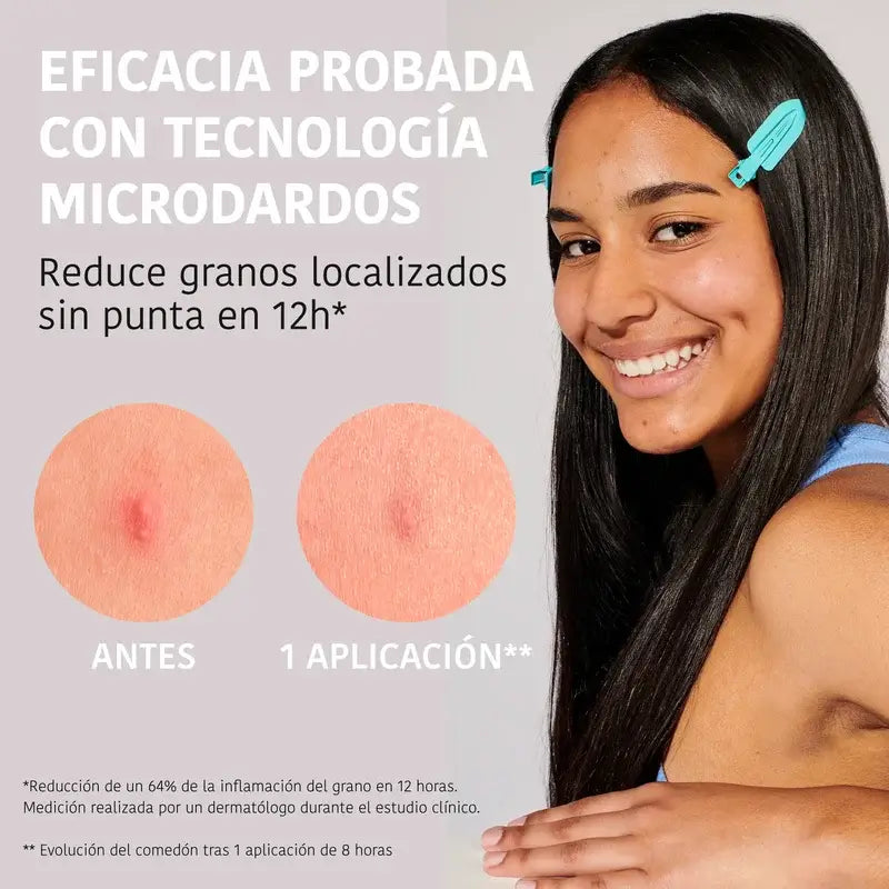 Iroha Nature Acne Prone Skin Microdart Patches, 12 pieces