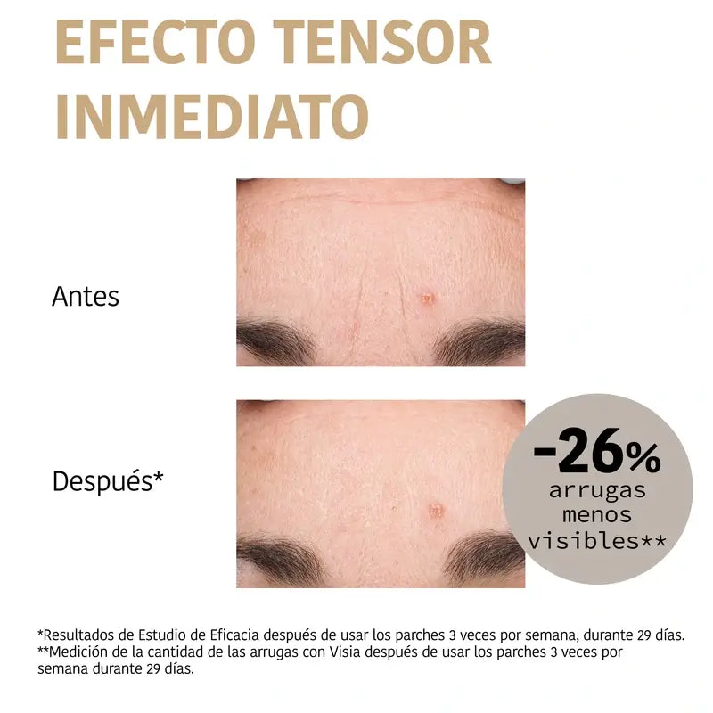 Iroha Nature Forehead Patches 99% Collagen (3 pcs + 1 Mist) , 3 pairs