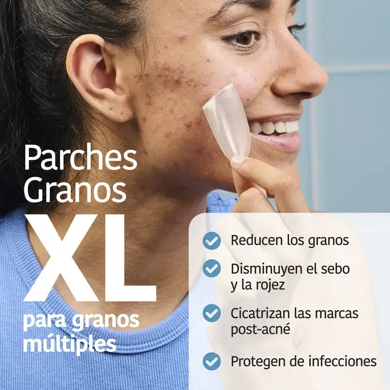 Iroha Nature Xl Pimple Patch , 5 units