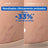 Mixa Anti-Stretch Marks Oil, 100 ml