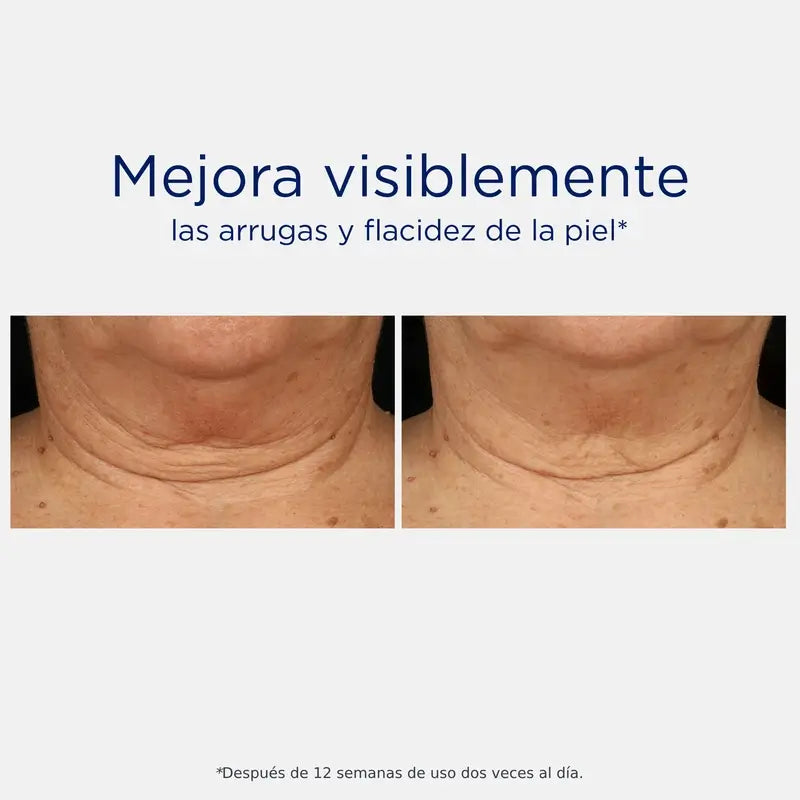 Neostrata Skin Active Tri-Therapy Lifting Serum, hyaluronic acid serum 30ml