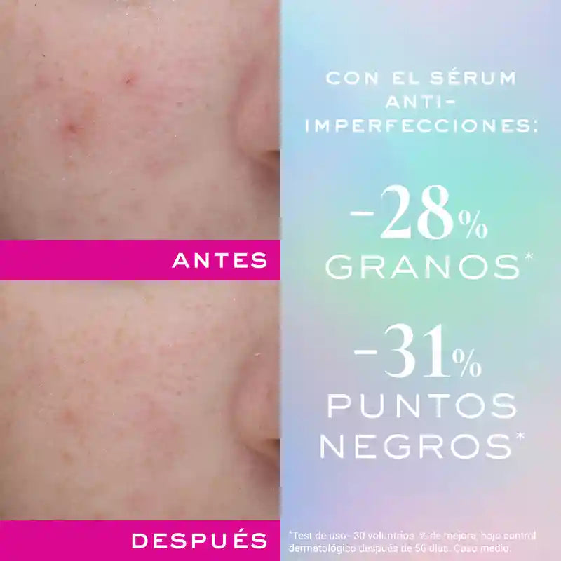 Nuxe Zinc Power Anti-Perfection Serum , 30 ml