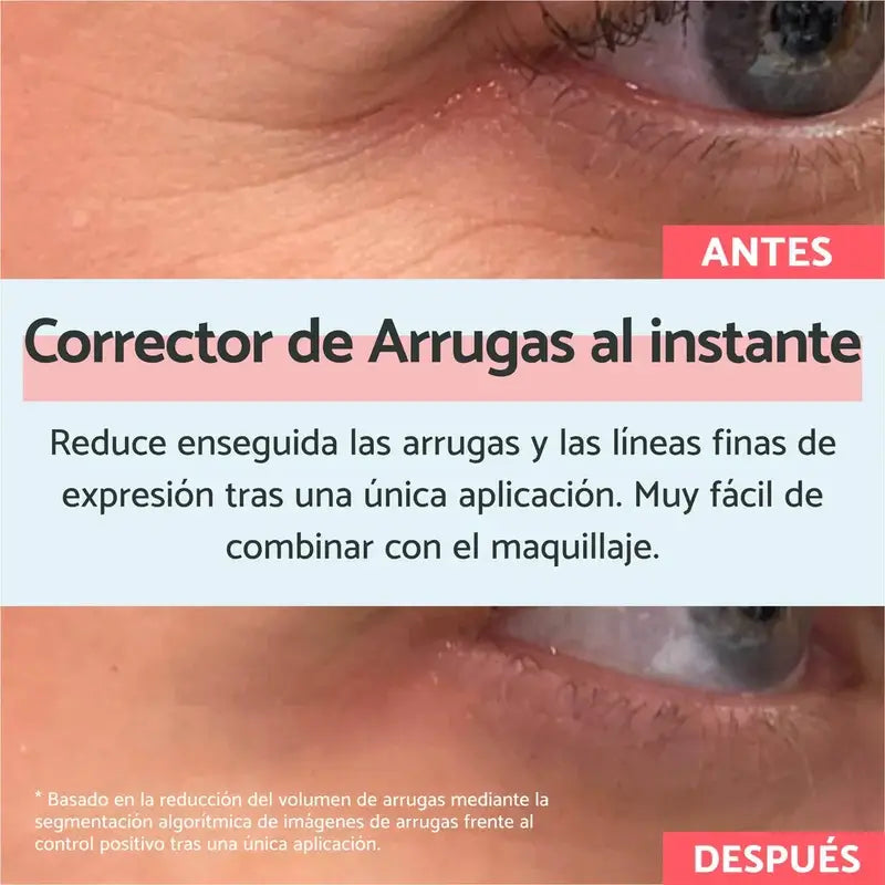 Remescar Instant Wrinkle Corrector, 8 ml