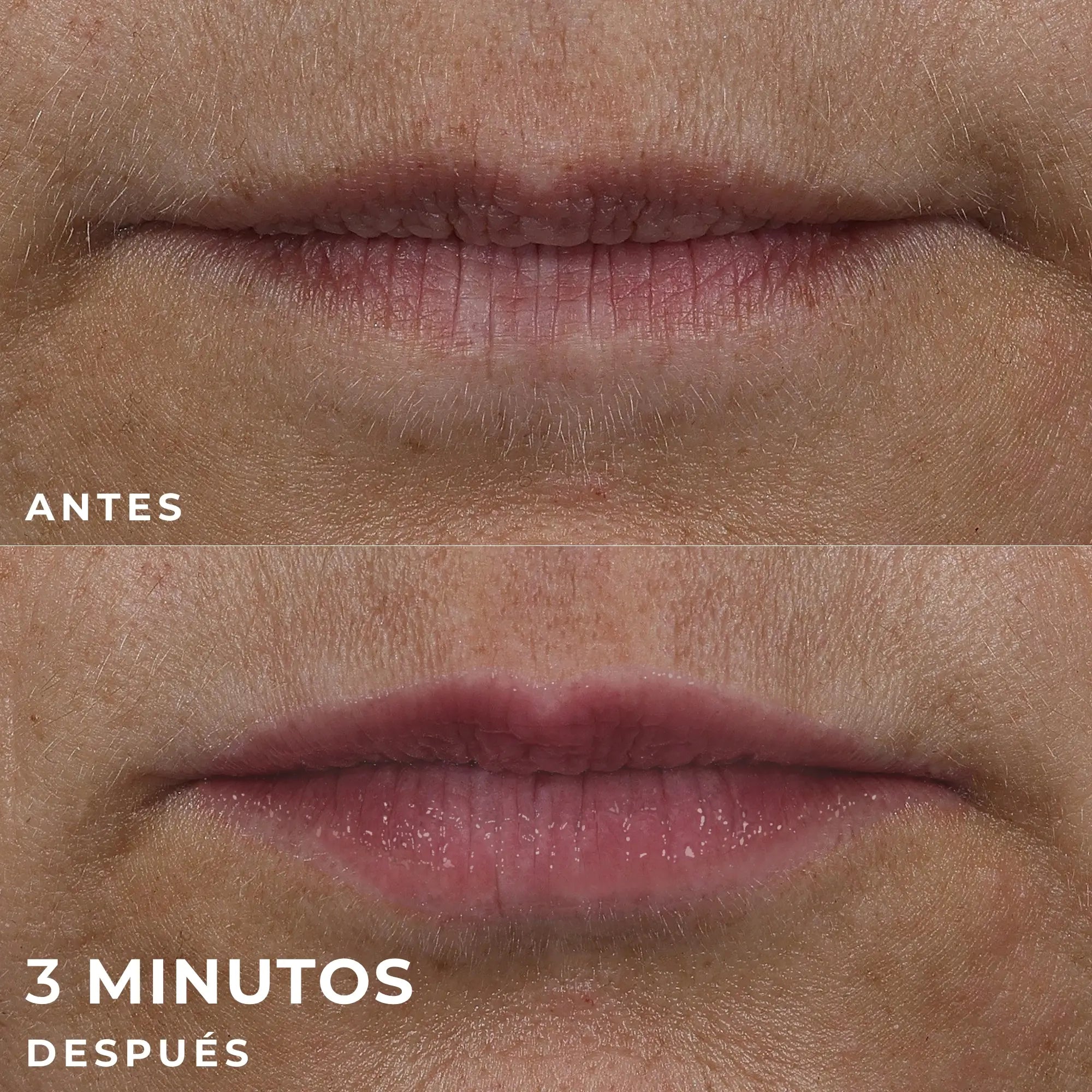 Roc Skincare Iberia Roc® Derm Correxion® Lip Volumizer 10Ml