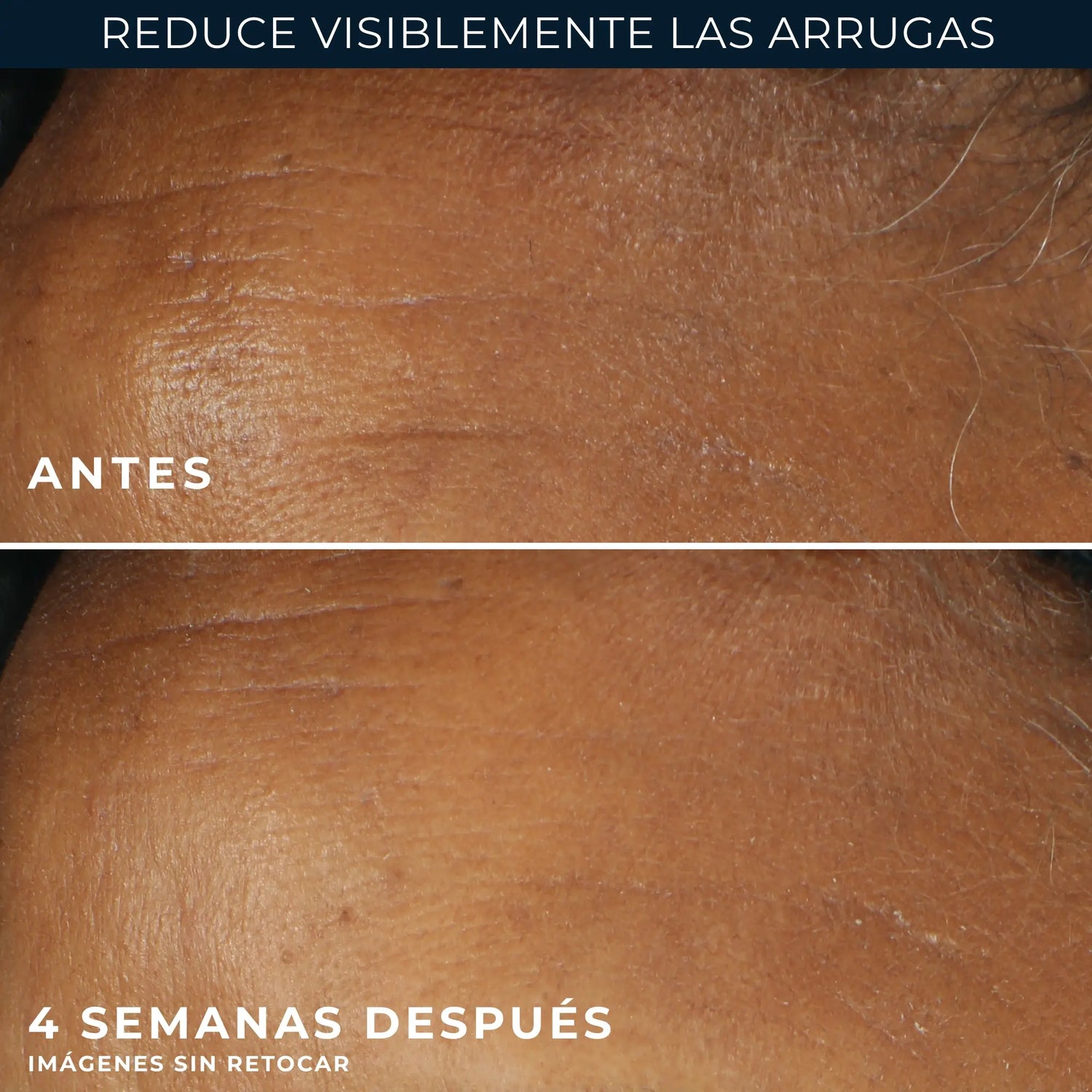 Roc Skincare Iberia Roc® Wrinkle Correct Day Cream Spf30 30Ml