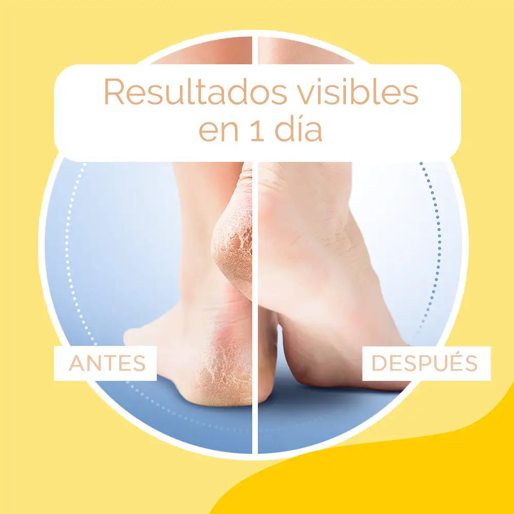 Scholl Cracked Heel Cream K+