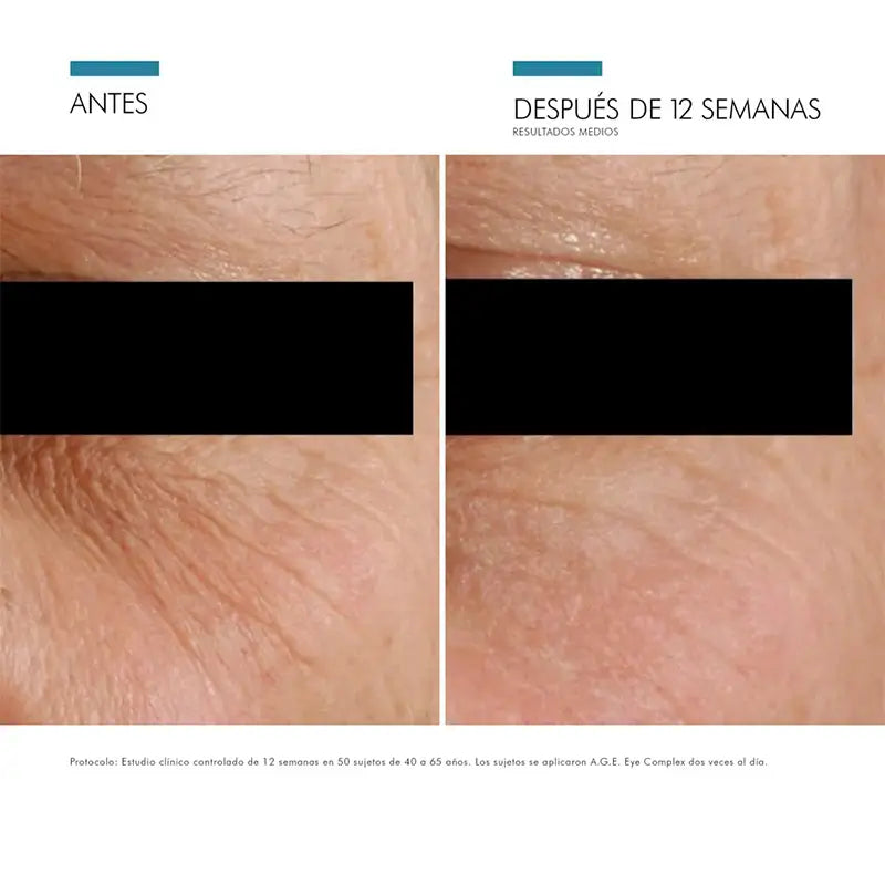 SkinCeuticals A.G.E. Eye Complex 15 ml