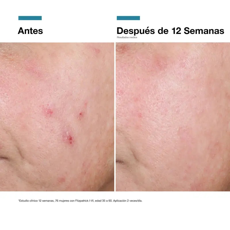 Skinceuticals Advanced Rgn-6, 50 ml
