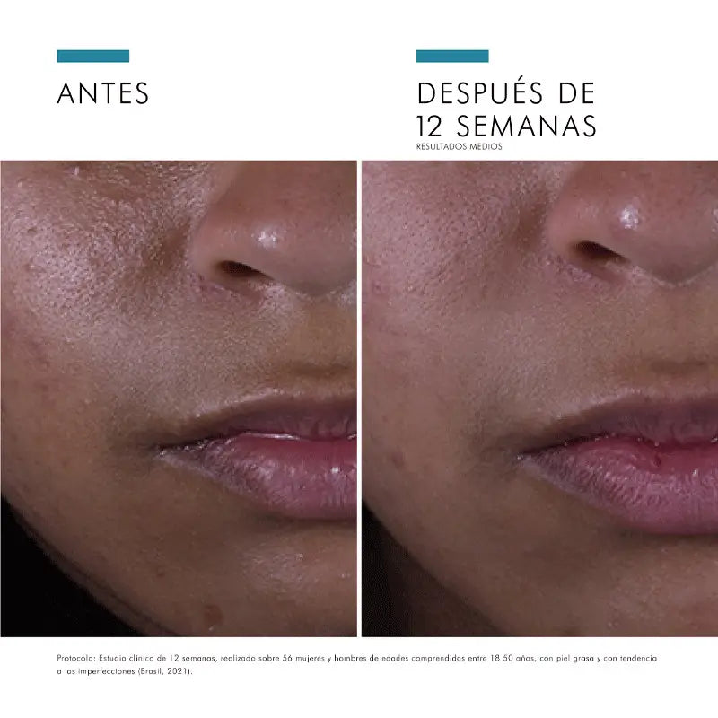 SkinCeuticals Silymarin Cf Serum 30 ml