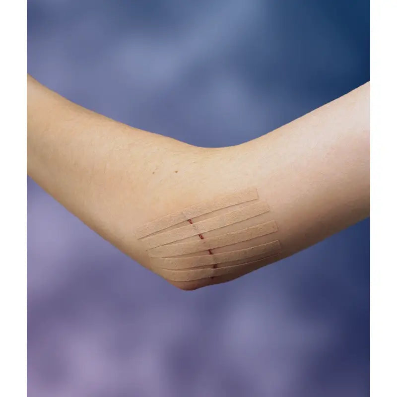 3M Steri-Strip Adhesive Suture 75 x 6 mm 3 Strips