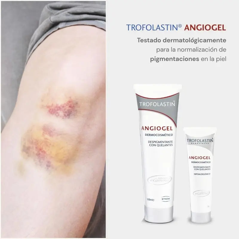 Trofolastin Angiogel Depigmenting Cream, 2x100 ml
