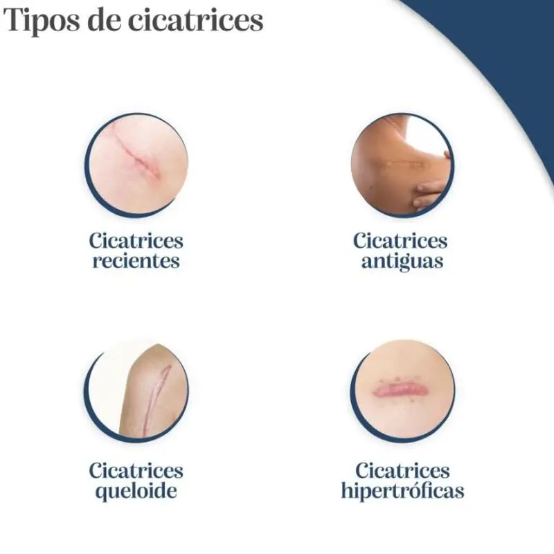 Trofolastin Scar Reducer 10 x 14 cm, 5 Patches
